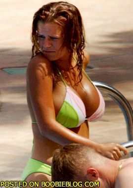 Kerry Katona Boob Job