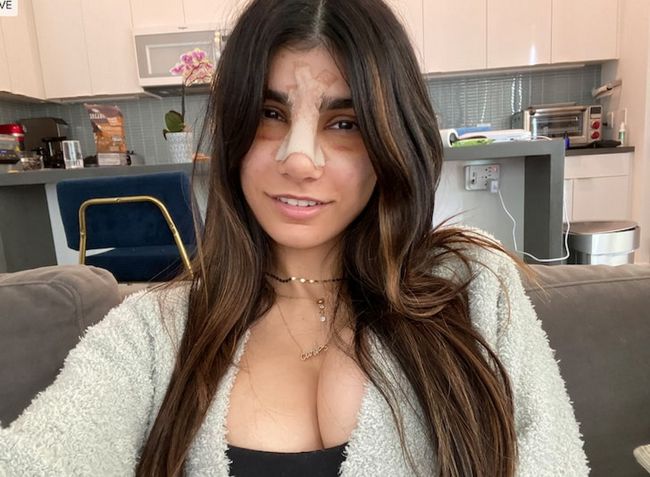 Mia Khalifa nose job